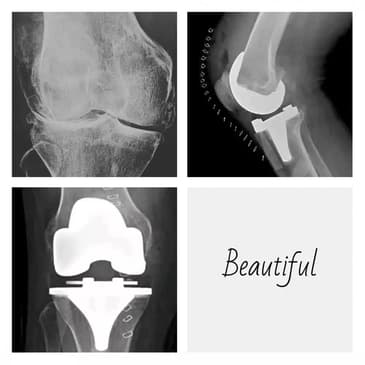 Slider image (7) Dr. Rodrigo Aguirre Rojas Orthopedic Surgeon in Mexico